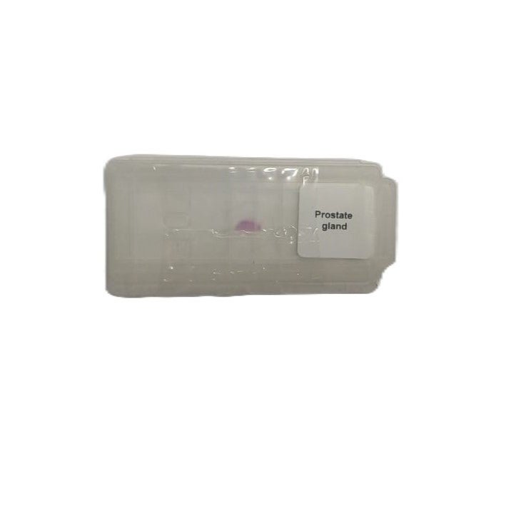 Microscope Slide - Prostate gland Individually packed in PP slide mailer