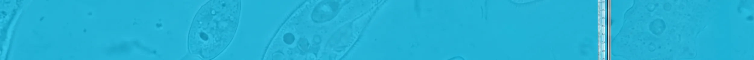Burettes banner