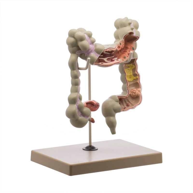 Anatomical Human Colon Model for Research and Education — SmartLabs