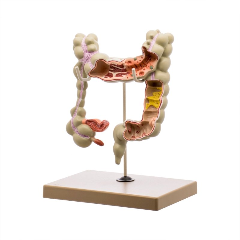 Colon Human Model