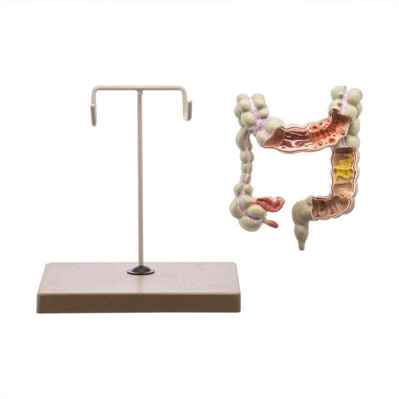 Anatomical Human Colon Model for Research and Education — SmartLabs