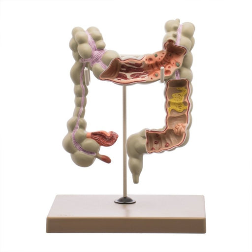 Colon Human Model