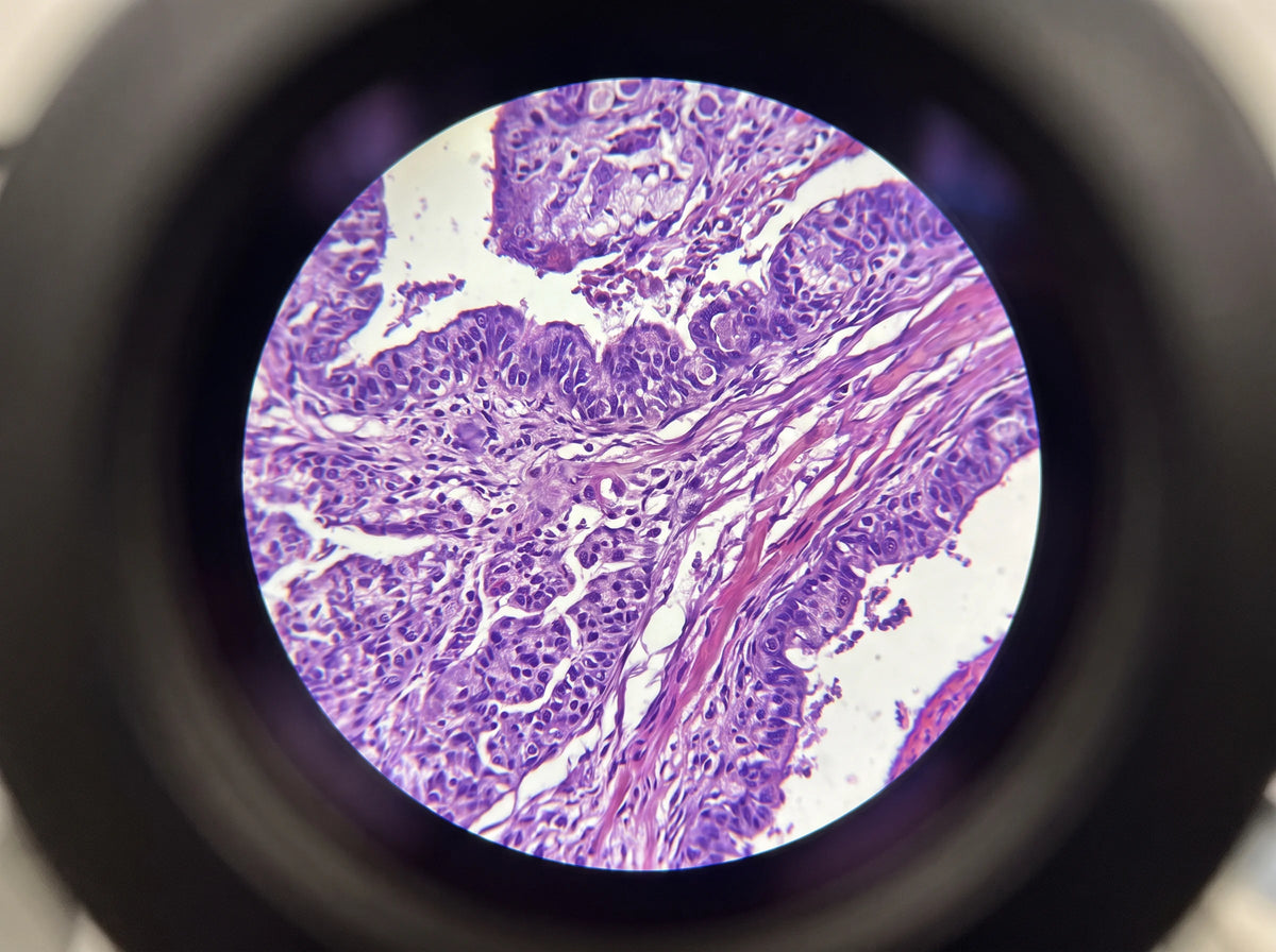 A stained tissue specimen seen through a microscope eyepiece