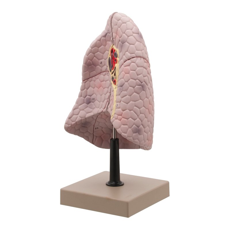 Human Right Lung Model