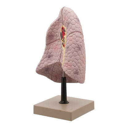 Human Right Lung Model