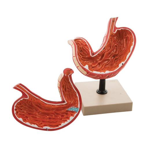 Human Stomach Model, 2 Parts, Three Dimensional
