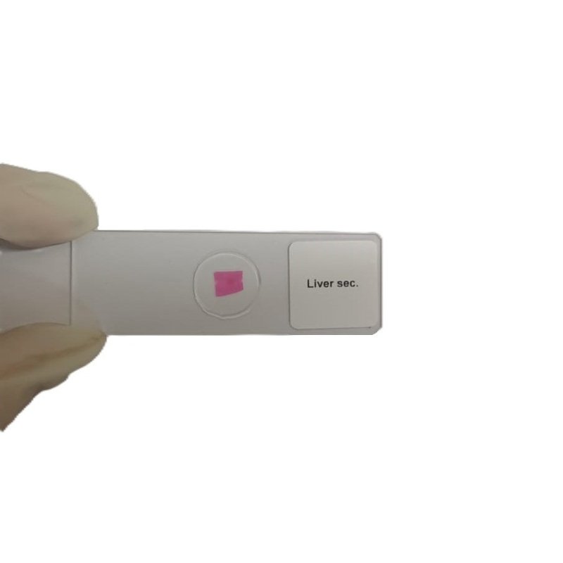 Microscope Slide - Liver sec. Individually packed in PP slide mailer