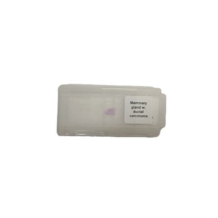 Microscope Slide - Mammary gland w. ductal carcinoma Individually packed in PP slide mailer