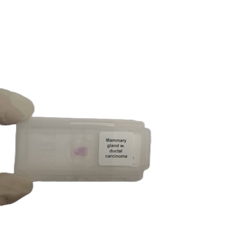 Microscope Slide - Mammary gland w. ductal carcinoma Individually packed in PP slide mailer