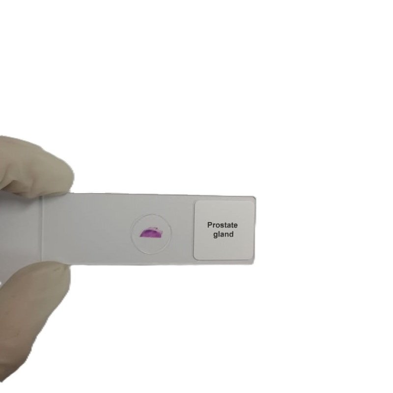 Microscope Slide - Prostate gland Individually packed in PP slide mailer