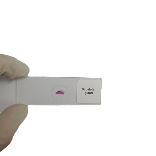 Microscope Slide - Prostate gland Individually packed in PP slide mailer