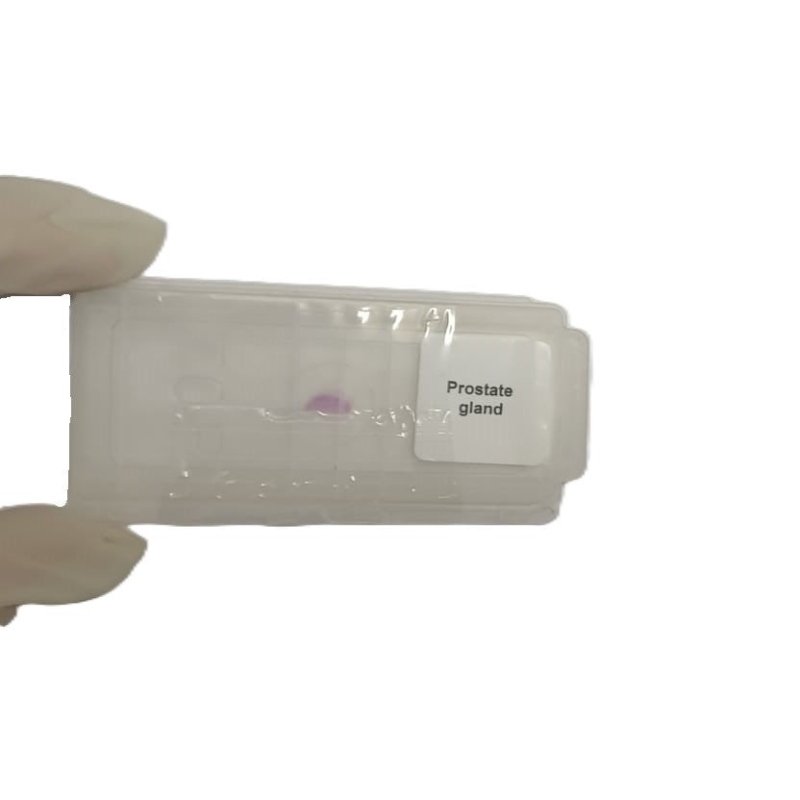 Microscope Slide - Prostate gland Individually packed in PP slide mailer