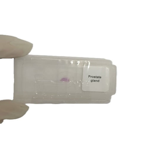 Microscope Slide - Prostate gland Individually packed in PP slide mailer