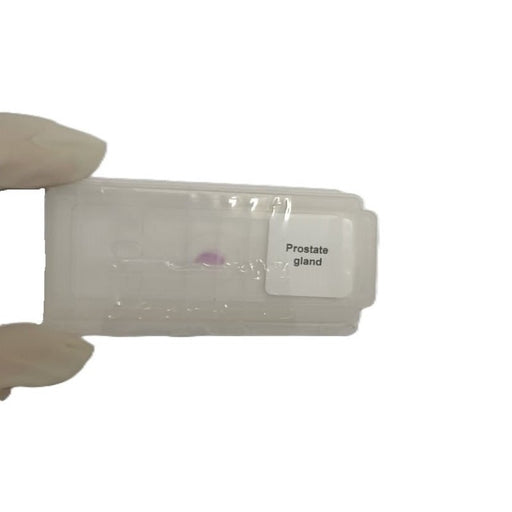 Microscope Slide - Prostate gland Individually packed in PP slide mailer