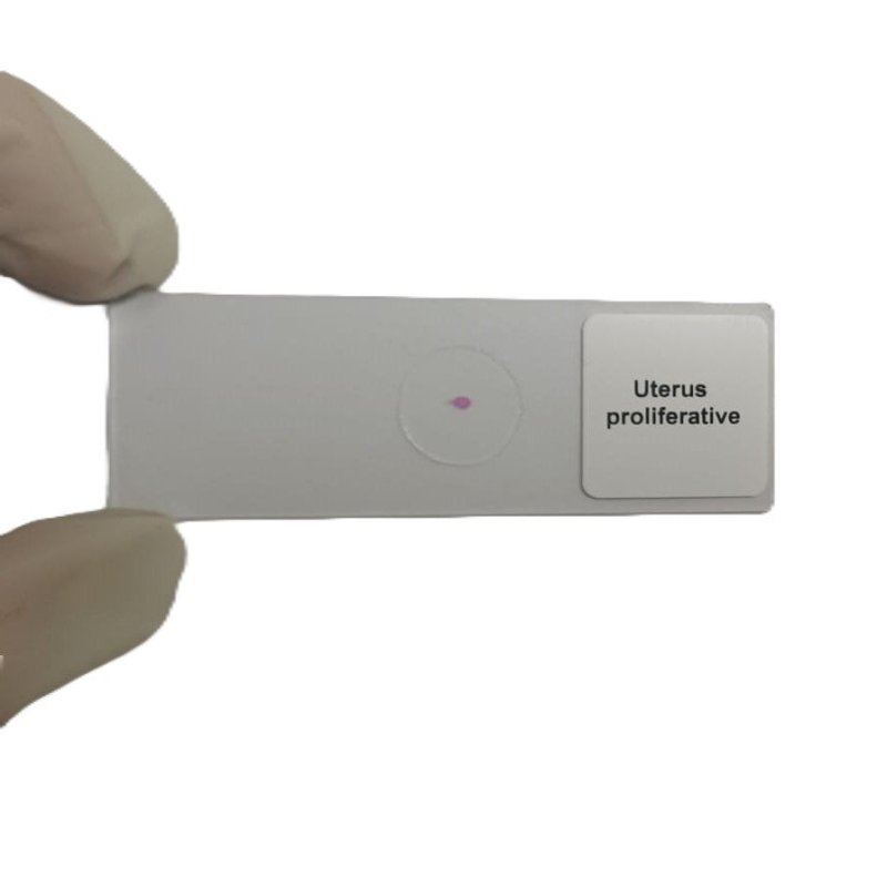 Microscope Slide - Uterus proliferative Individually packed in PP slide mailer
