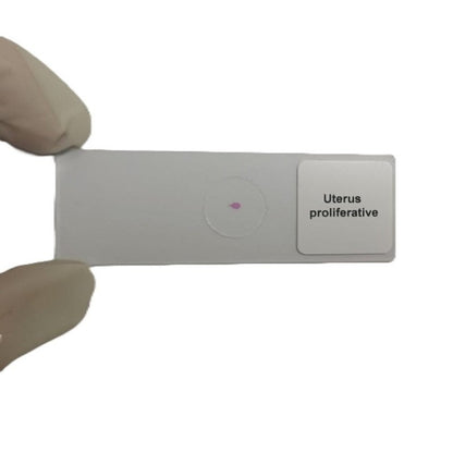 Microscope Slide - Uterus proliferative Individually packed in PP slide mailer