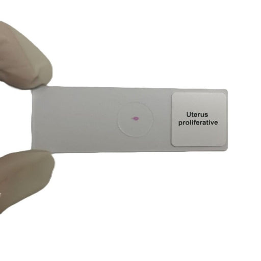 Microscope Slide - Uterus proliferative Individually packed in PP slide mailer