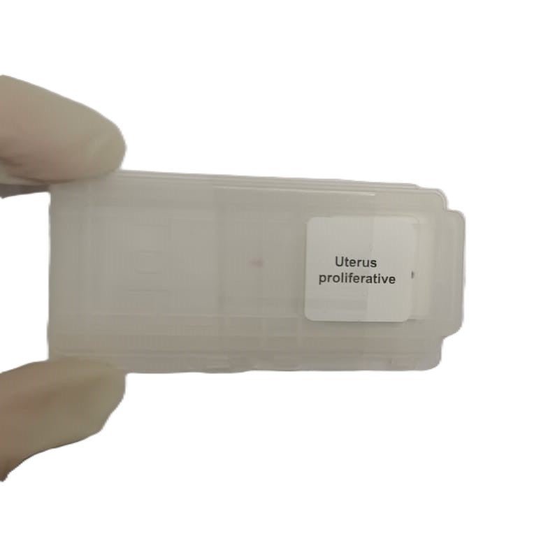 Microscope Slide - Uterus proliferative Individually packed in PP slide mailer