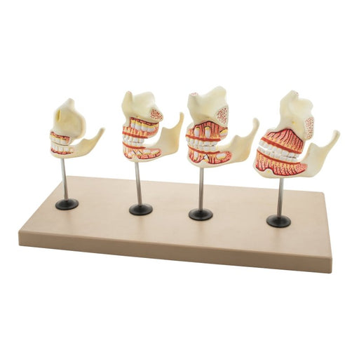 Model Dentition Development Set