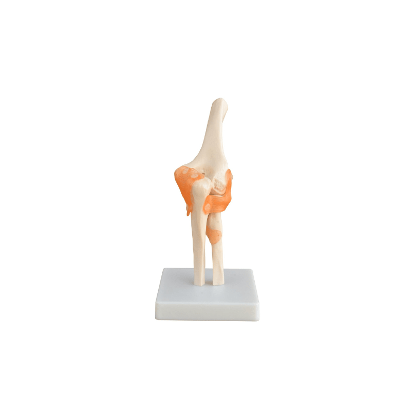 Model, Human Elbow Joint - on base