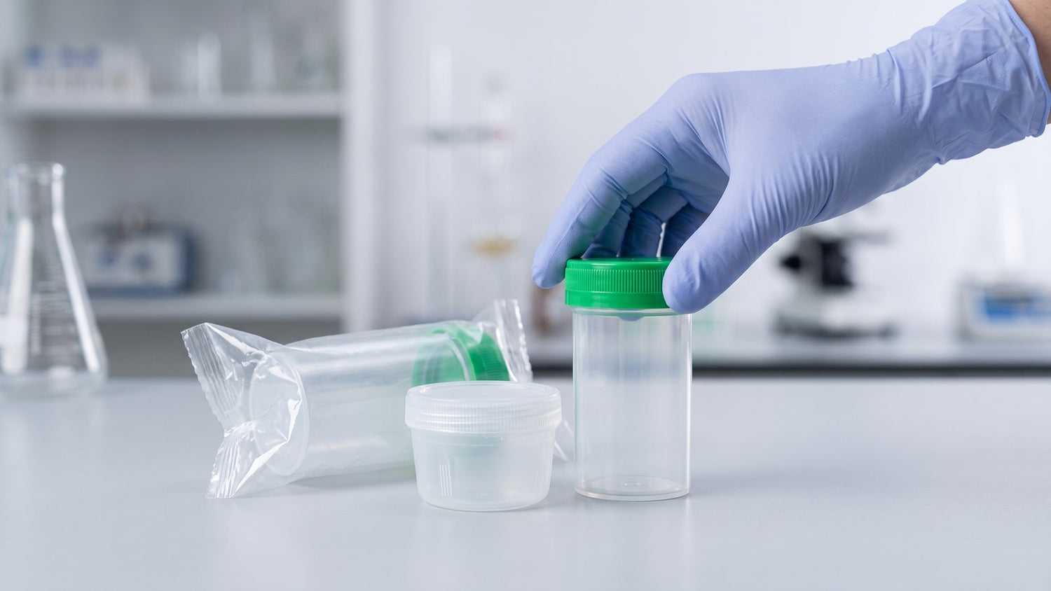 What is a specimen container